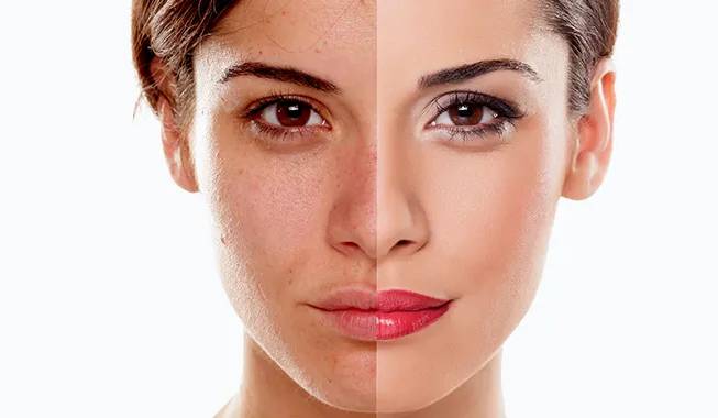 Skin renewal store
