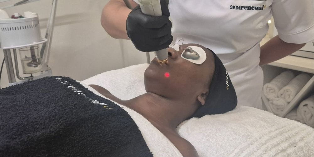 Thumbnail for Acne Solutions at Skin Renewal