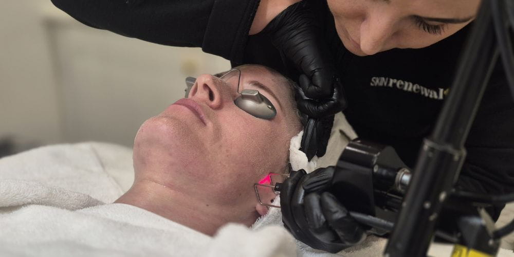 Thumbnail for The Difference Between Laser and Light Treatments