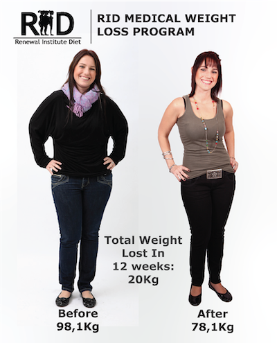 Weight loss programs for women