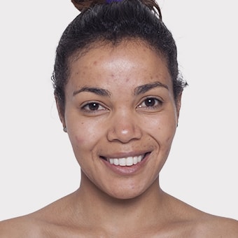 Mooimaak | Behind the Scenes | Skin Renewal | Kyknet