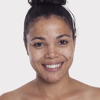 Mooimaak | Behind the Scenes | Skin Renewal | Kyknet