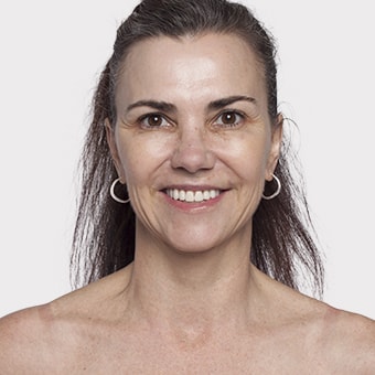 Mooimaak | Behind the Scenes | Skin Renewal | Kyknet