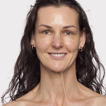 Mooimaak | Behind the Scenes | Skin Renewal | Kyknet